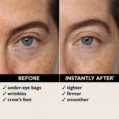 Eleora Perfections™ - Instant Eye Lift & Skin Tightener