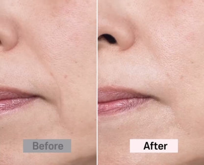 Eleora Perfection™ Advanced Calcium Volume Balm